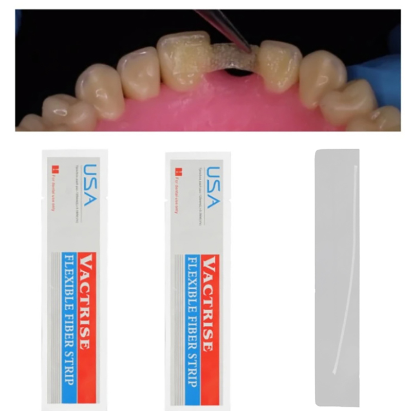 1Pcs Glass Splint Loose Tooth  - Teeth Whitening Gel Syringes review and price