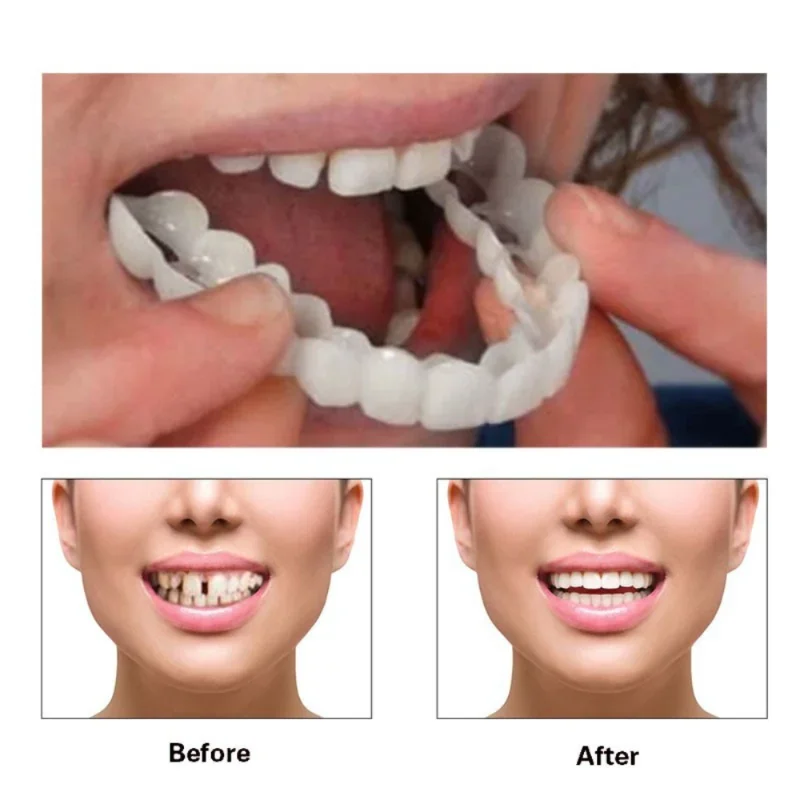 Daily Selfie Must Have Teeth V - Teeth Whitening Effective review and price