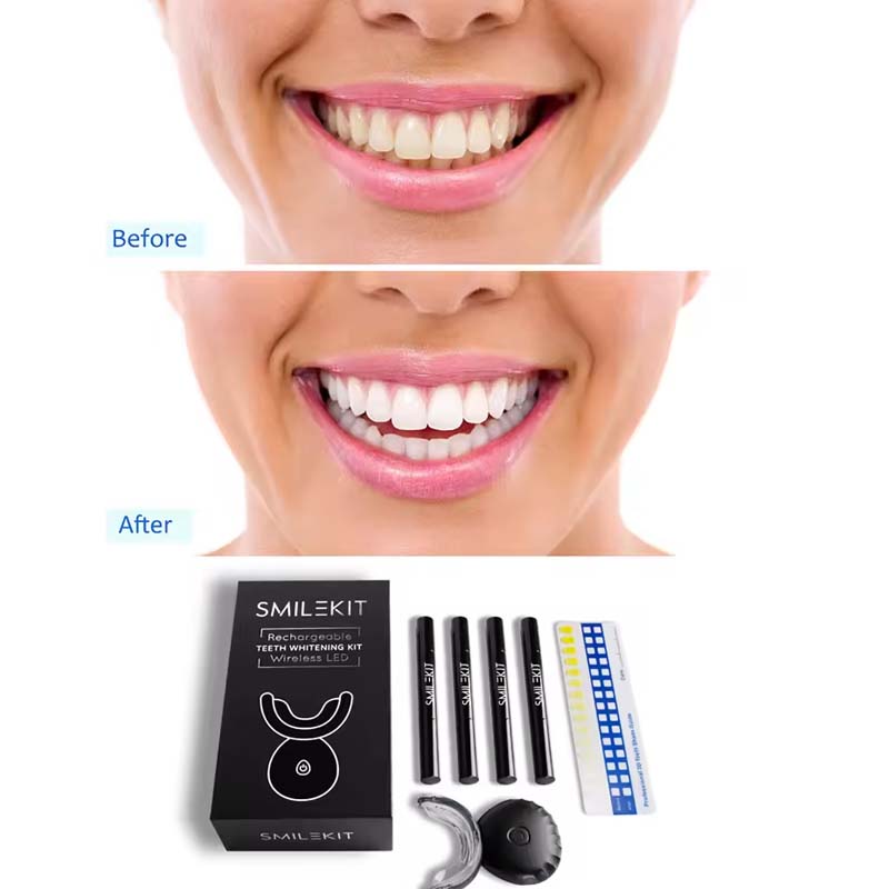 Wholesale Approved Private log - Teeth Whitening Logo review and price