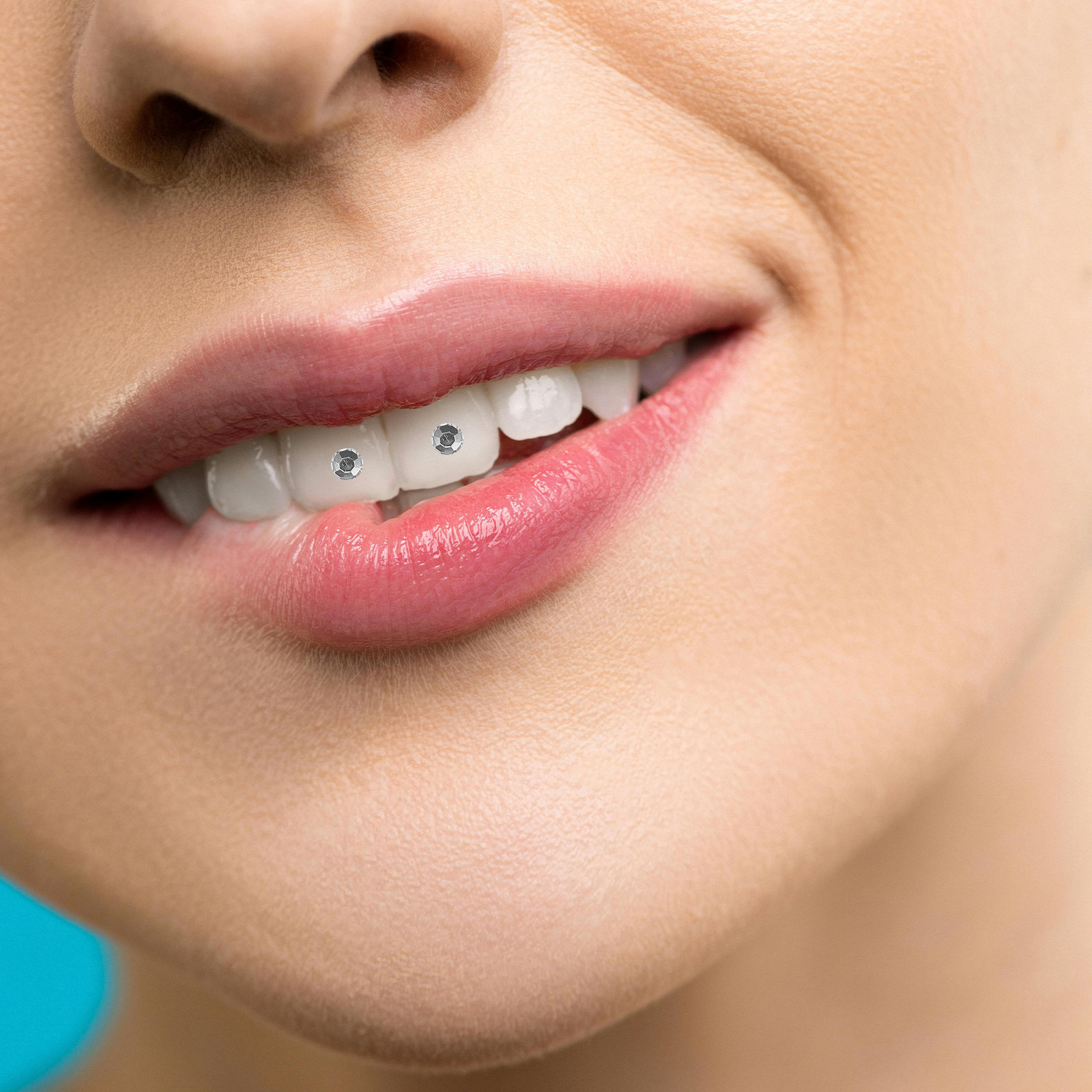 10Pcs Tooth Gems Kit for Teeth - Tooth Gem Kit review and price