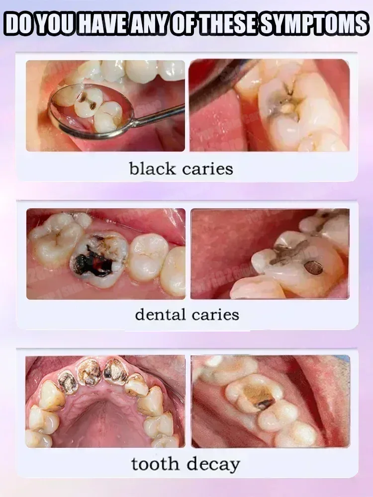 Hot sales Best-selling, Scient - Teeth Whitening Best review and price