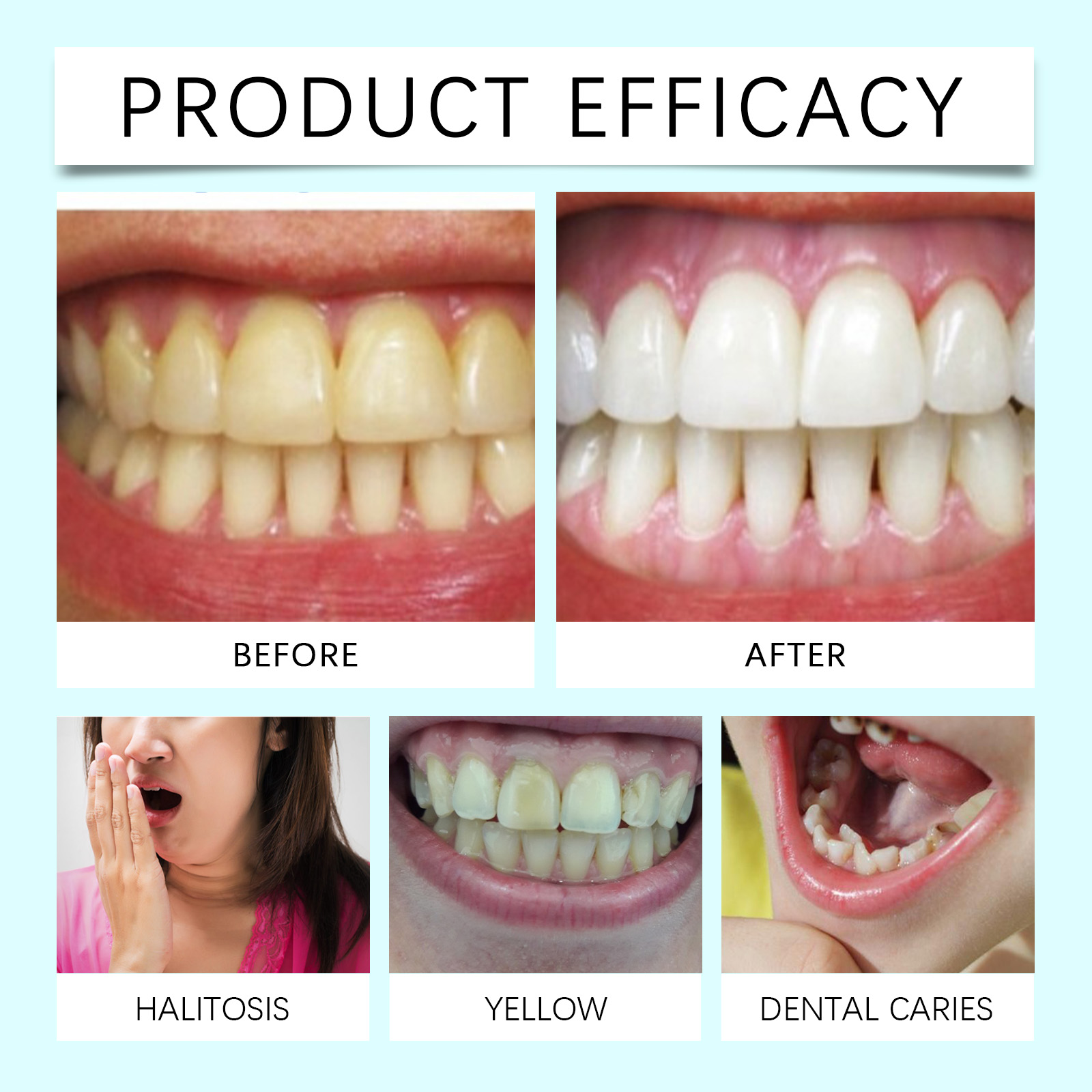 Tooth Whitening Strips Remove  - Teeth Whitening Or Bleaching review and price