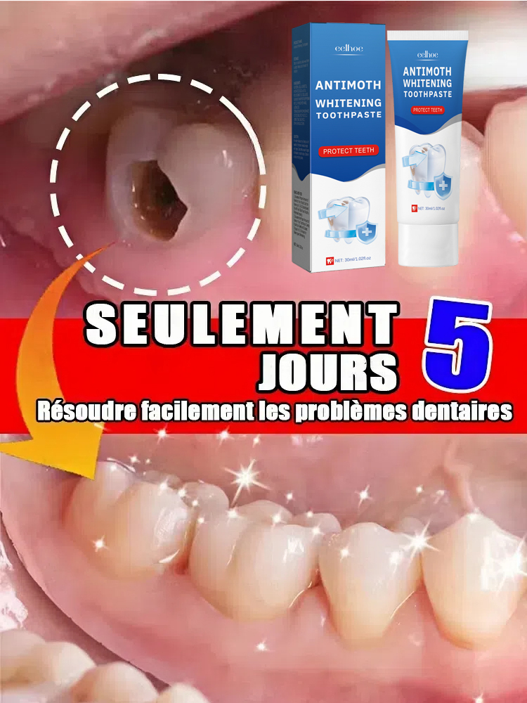 2025 Remove Cavities Effective - Teeth Whitening Effective review and price