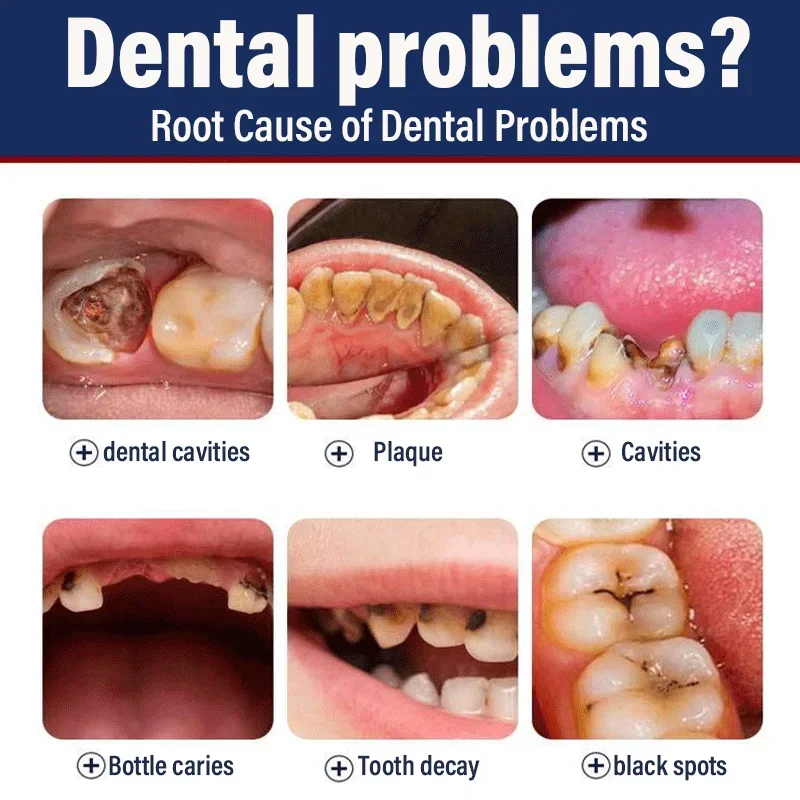 2025 Remove Cavities Effective - Teeth Whitening Effective review and price