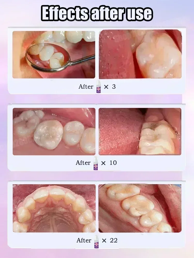 Teeth Cleaning Toothpaste Remo - Teeth Whitening Effective review and price